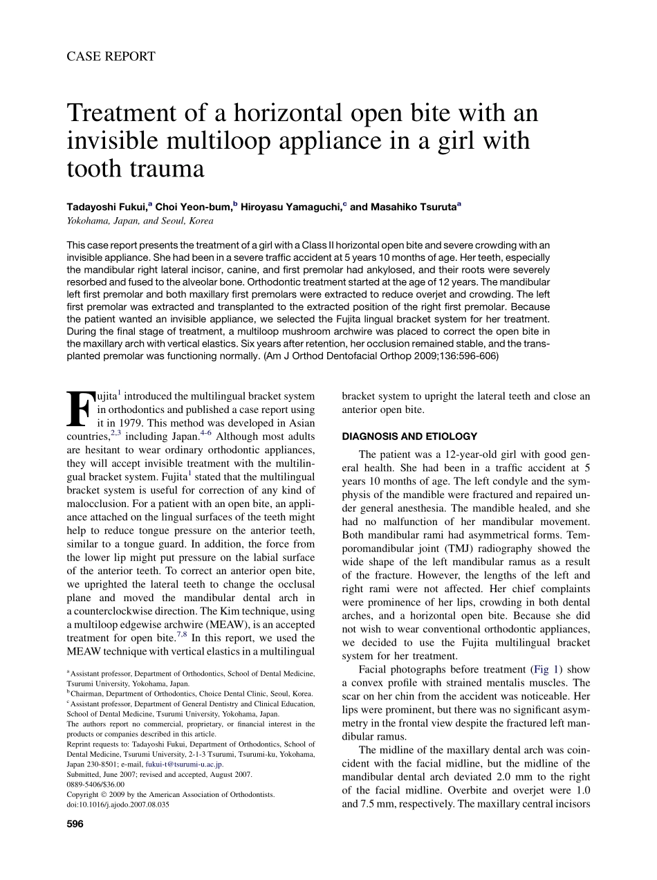 Fukui_2009_American-Journal-of-Orthodontics-and-Dentofacial-Orthopedics.pdf_第1页