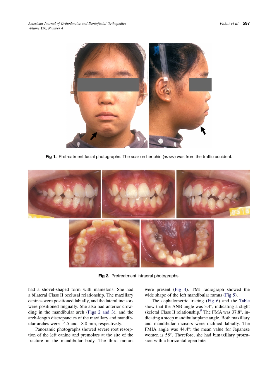 Fukui_2009_American-Journal-of-Orthodontics-and-Dentofacial-Orthopedics.pdf_第2页