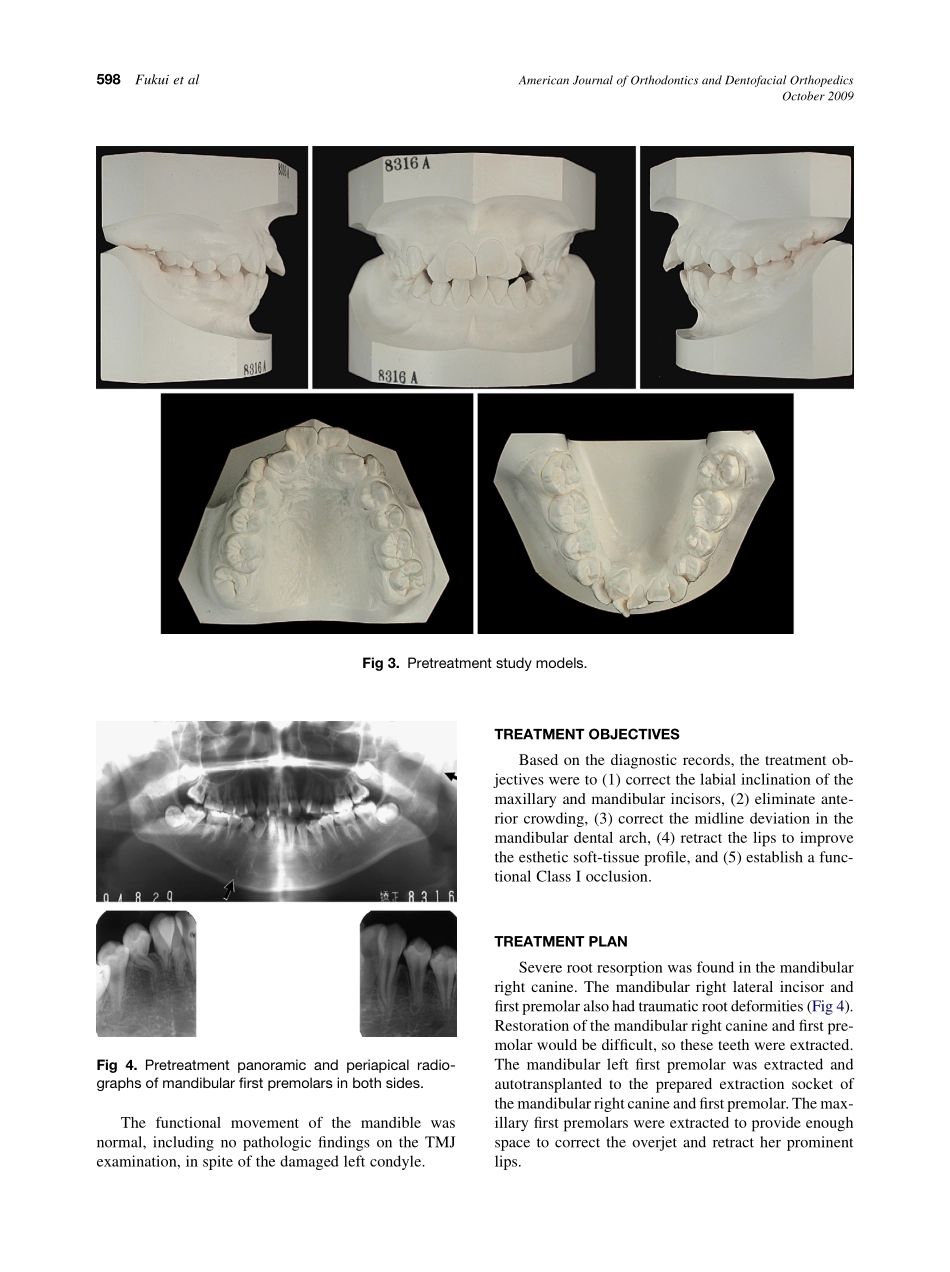 Fukui_2009_American-Journal-of-Orthodontics-and-Dentofacial-Orthopedics.pdf_第3页