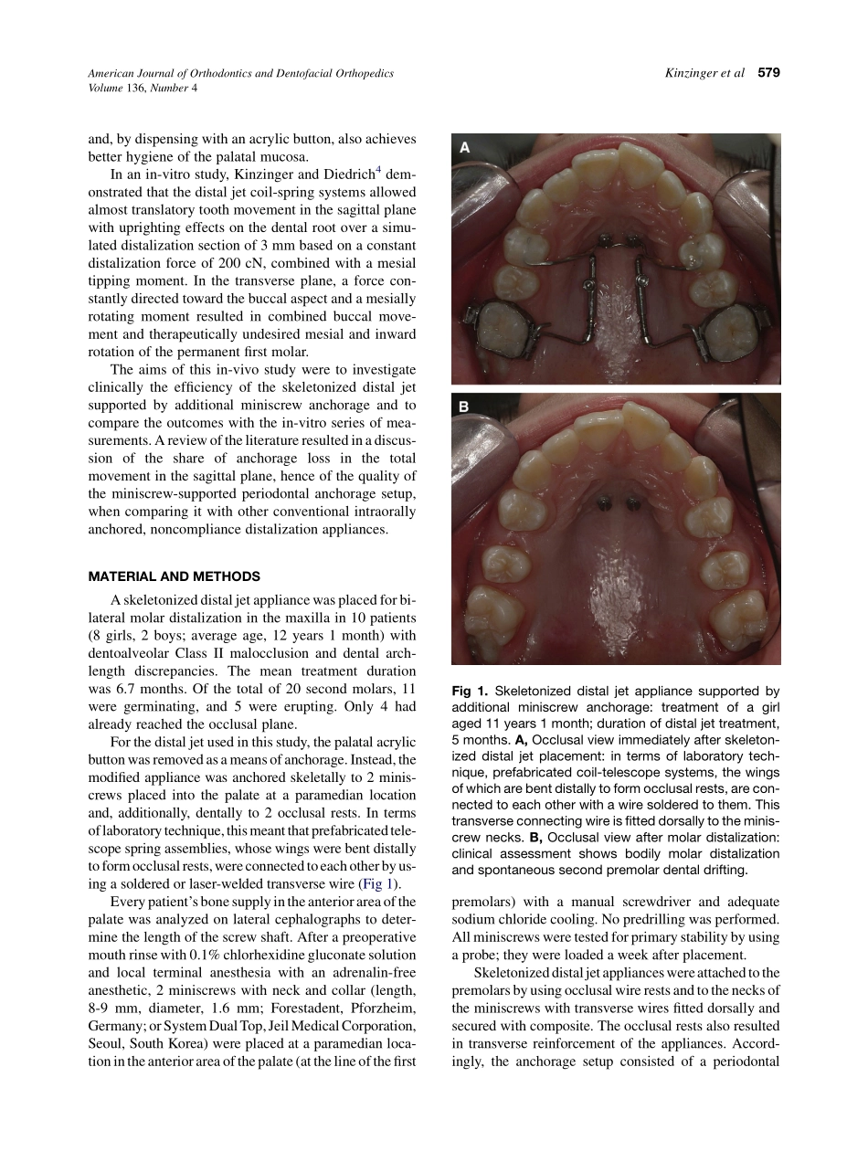 Kinzinger_2009_American-Journal-of-Orthodontics-and-Dentofacial-Orthopedics.pdf_第2页