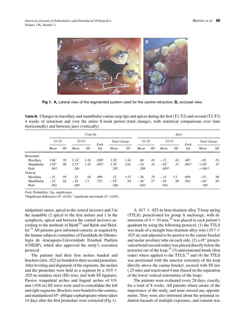 Martins_Changes-over-time-in-canine-retraction-An-implant-study_2009.pdf_第3页