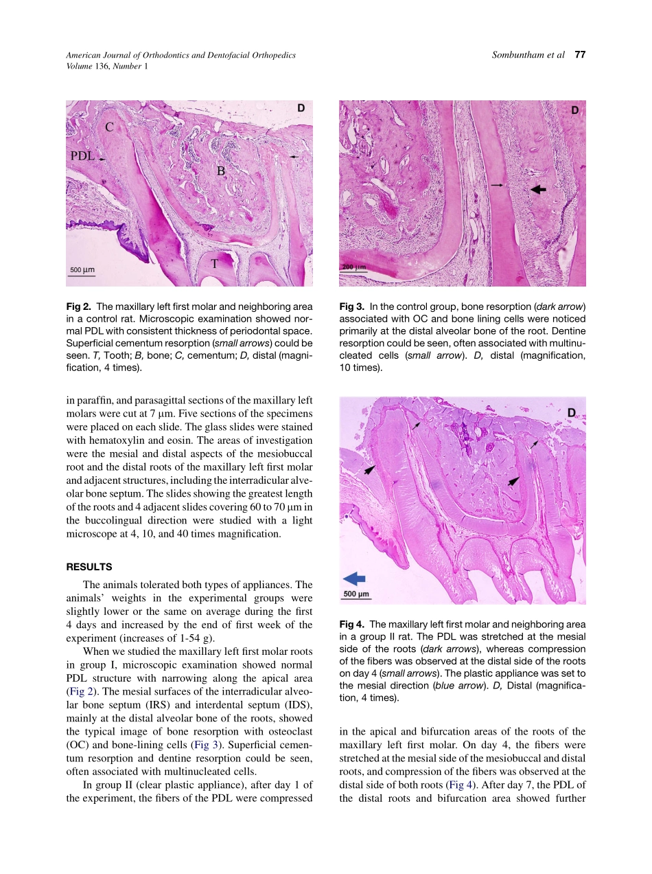 Sombuntham_Early-tooth-movement-with-a-clear-plastic-appliance-in-rats_2009.pdf_第3页