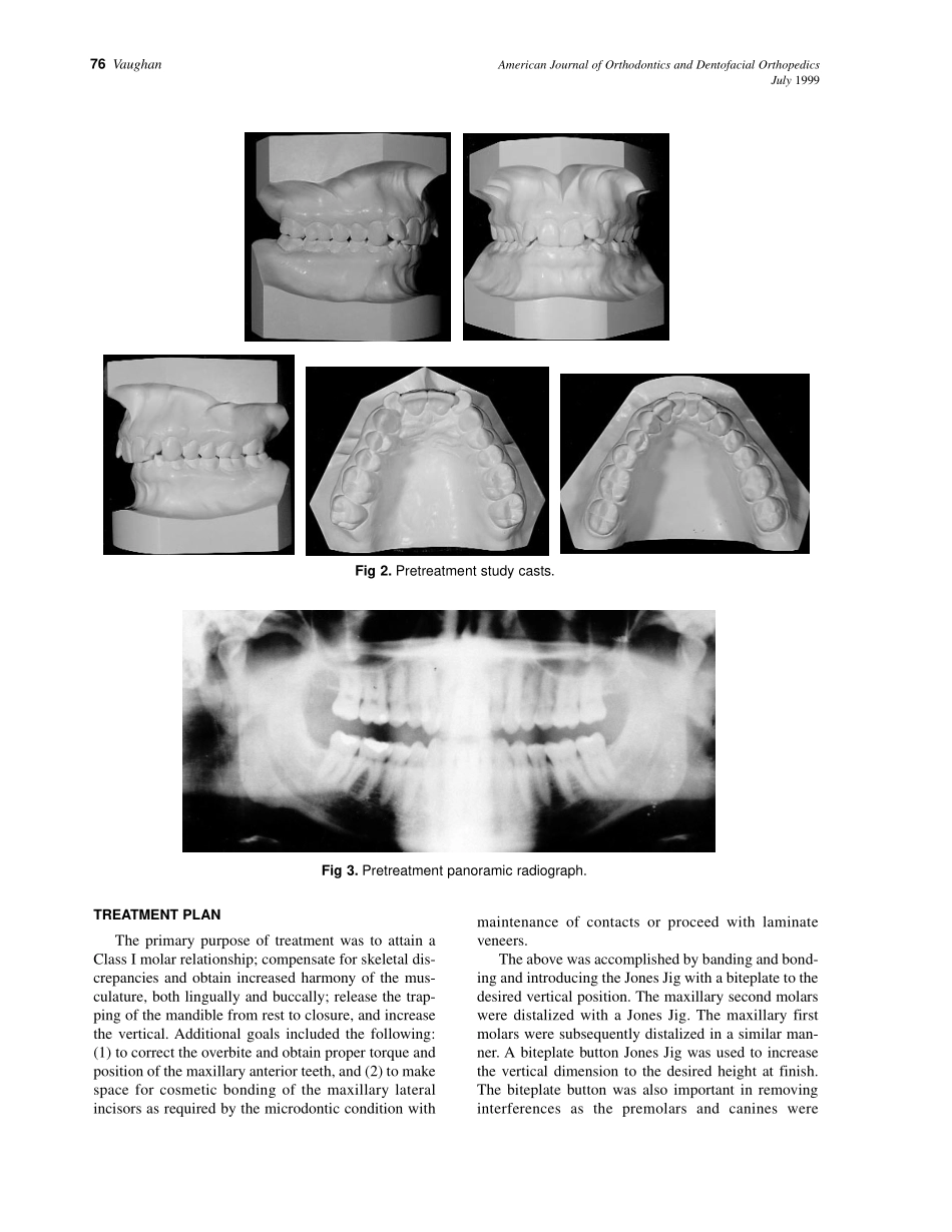 Vaughan_1999_116_1_by_OrTHoTaMiNe.pdf_第2页