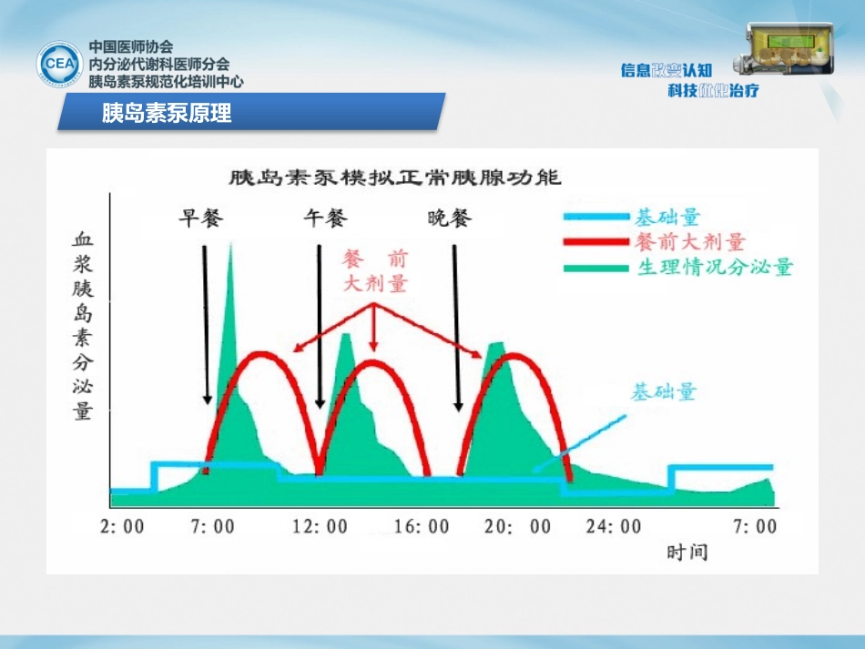 6-胰岛素泵初始剂量设定及精细调整.ppt_第3页