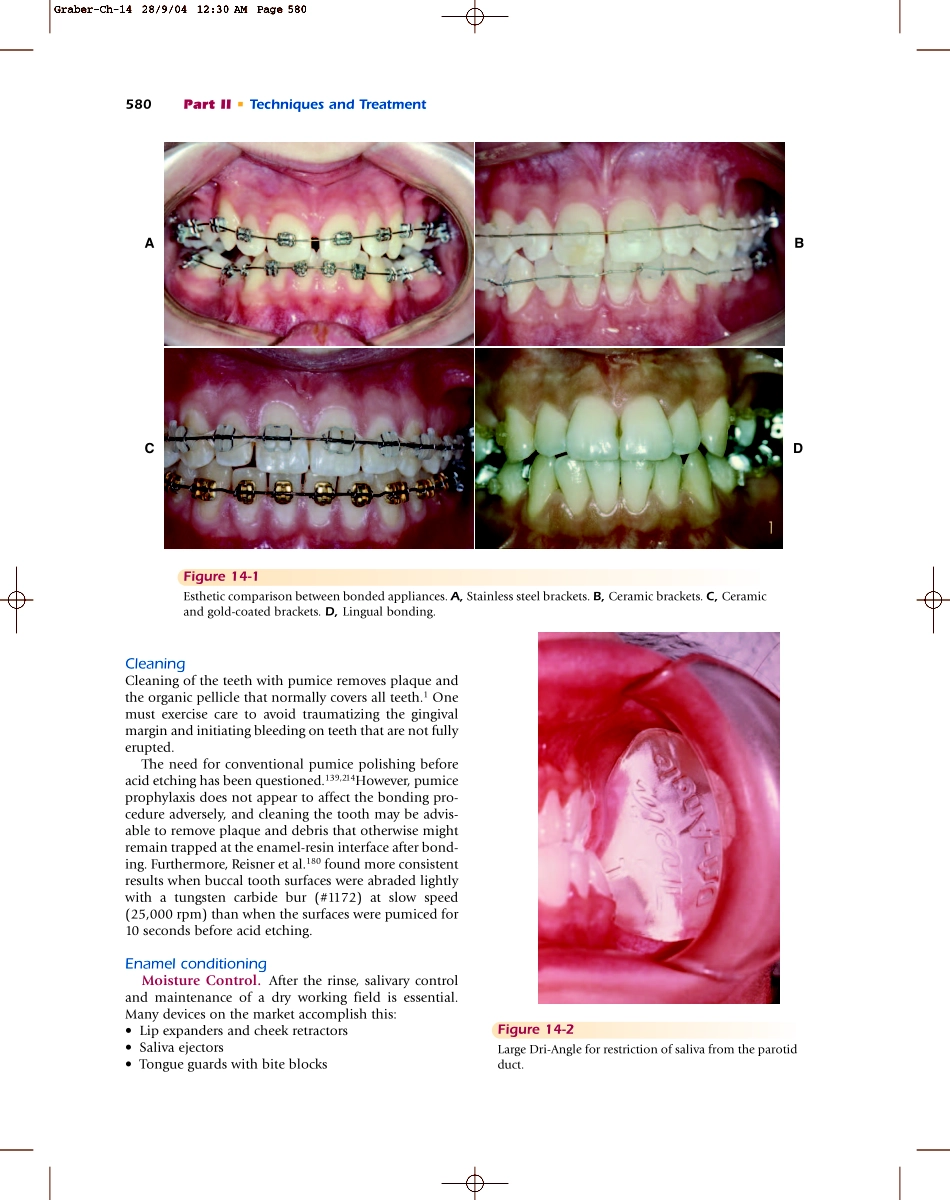 Bonding in Orthodontics.pdf_第2页