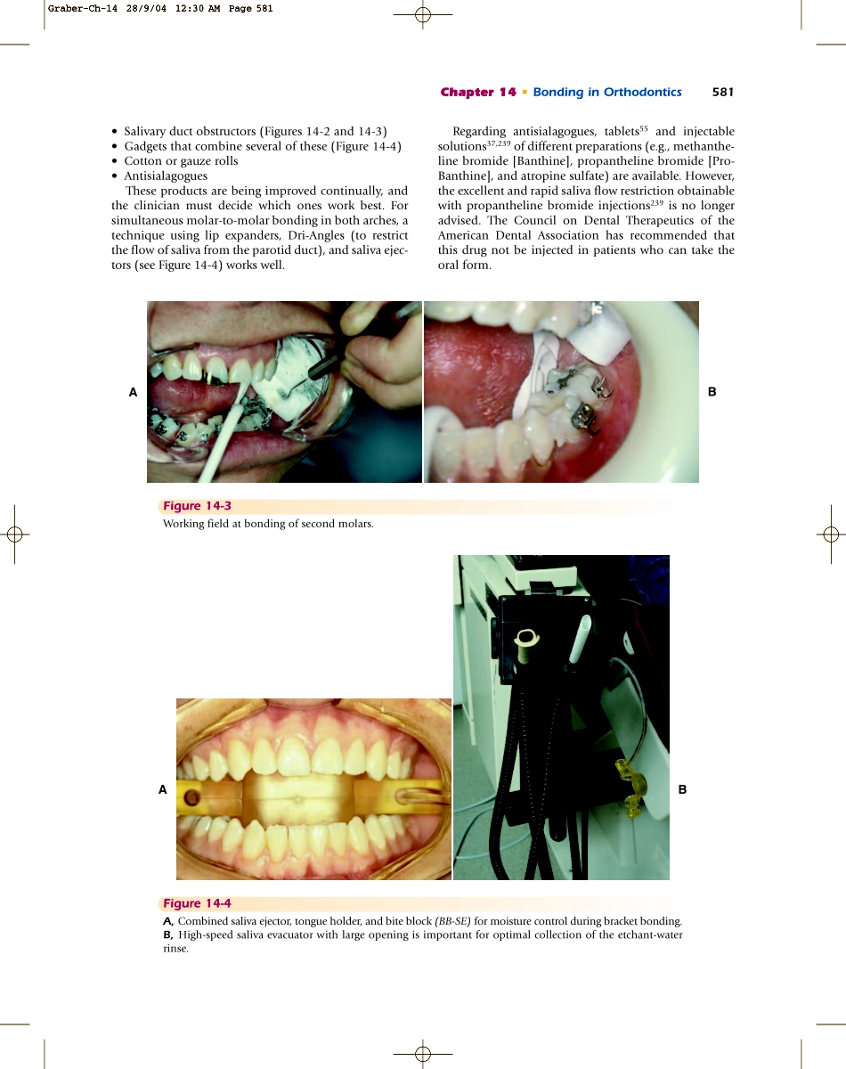 Bonding in Orthodontics.pdf_第3页