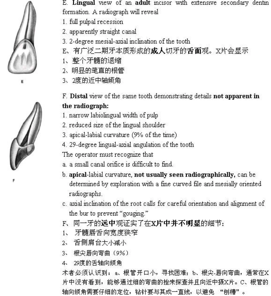 Endo第五版中各牙的牙髓解剖及冠部洞型预备.pdf_第3页