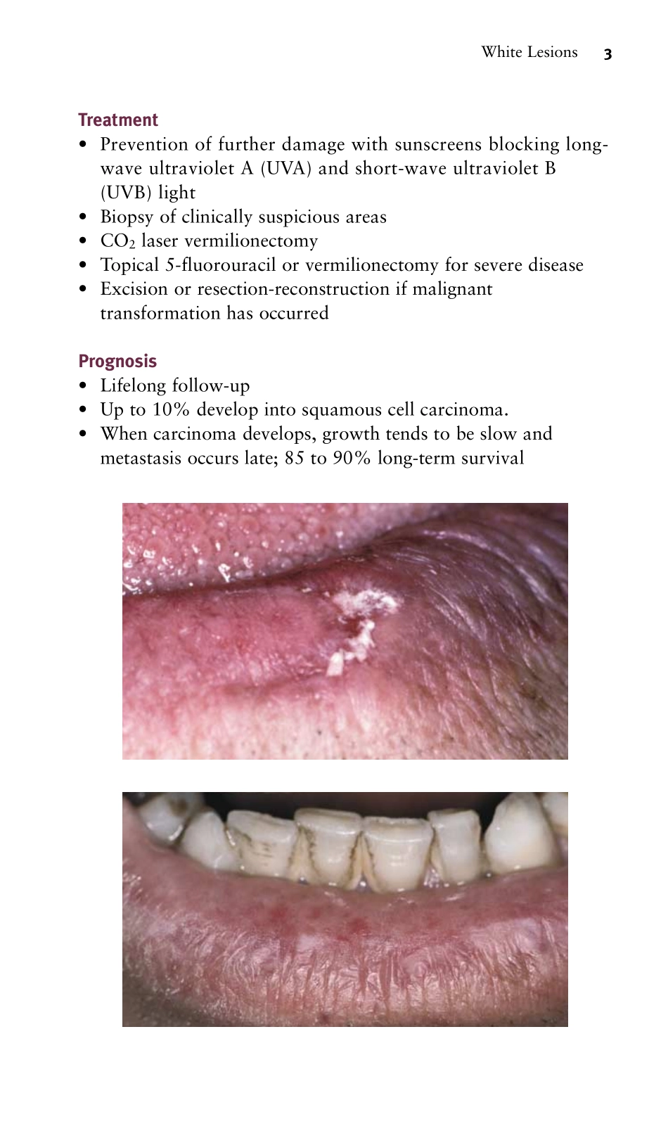 PDQ Oral Disease Diagnosis and Treatment.pdf_第2页