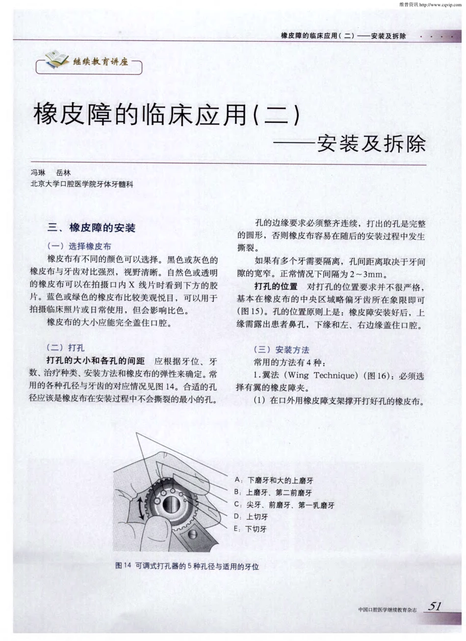 橡皮障的临床应用（二）——安装及拆除.pdf_第1页