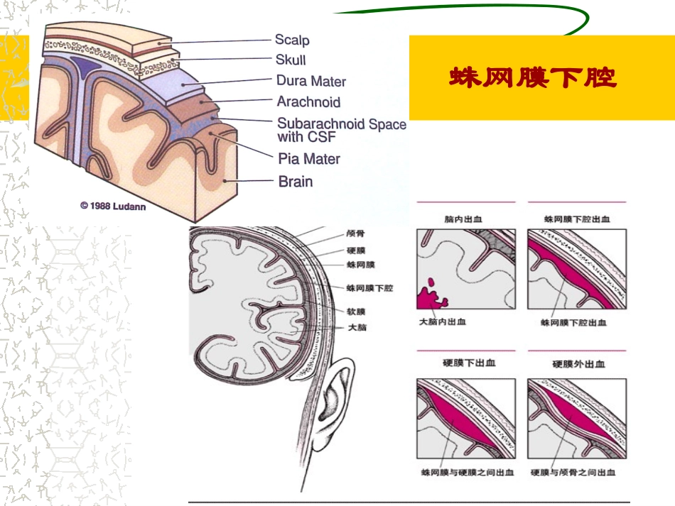 2025年医学资料：5)级放射口腔SAH.ppt_第2页