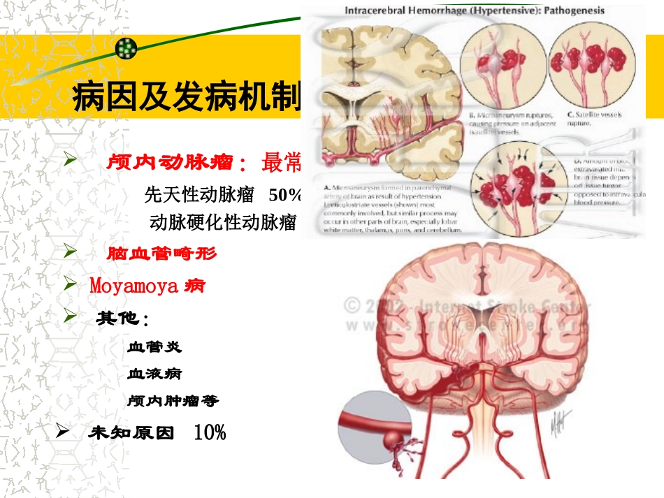 2025年医学资料：5)级放射口腔SAH.ppt_第3页