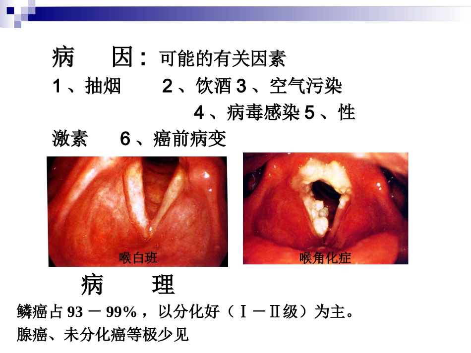 2025年医学资料：7)喉癌 喉阻塞 气管切开术2.ppt_第3页