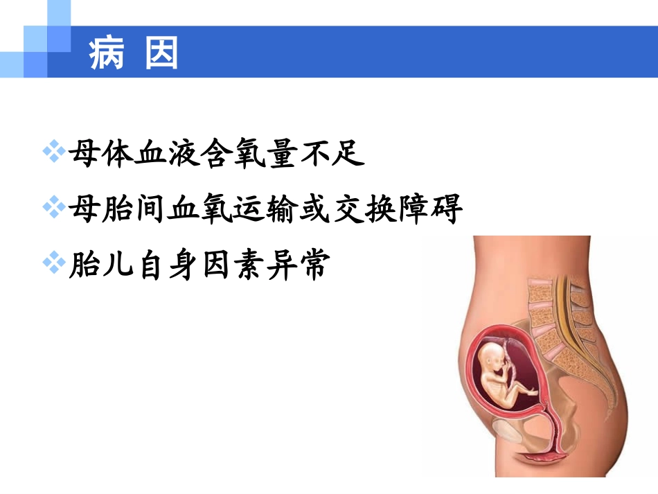 2025年医学资料：7)胎儿窘迫.ppt_第3页