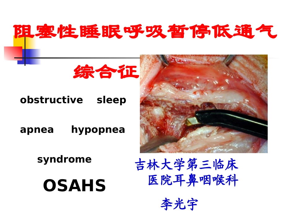 2025年医学资料：8)0SAHS.ppt_第1页