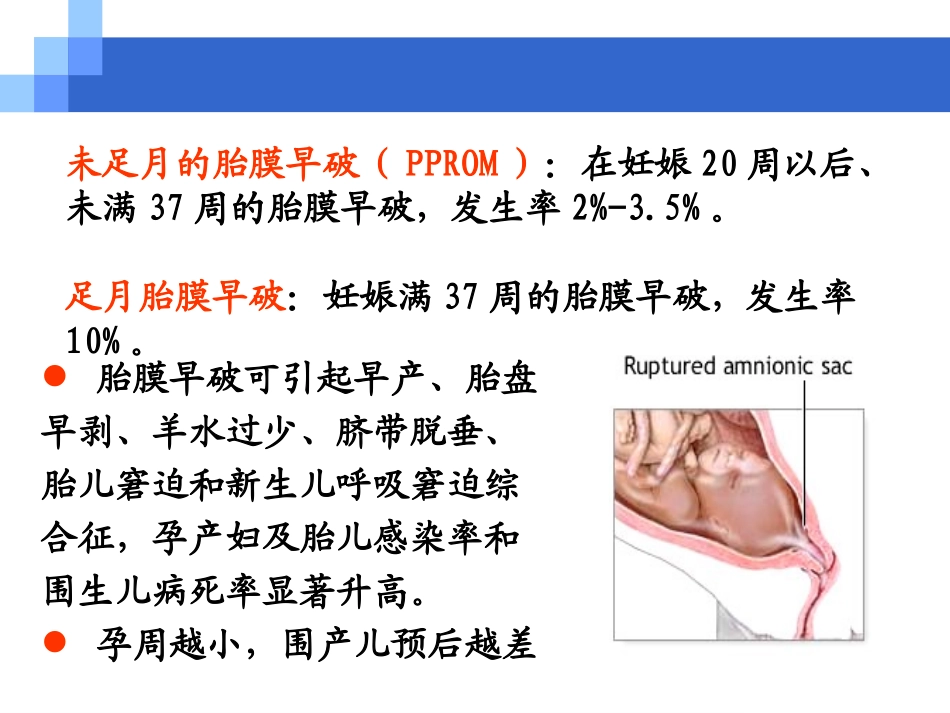 2025年医学资料：8)胎膜早破.ppt_第3页