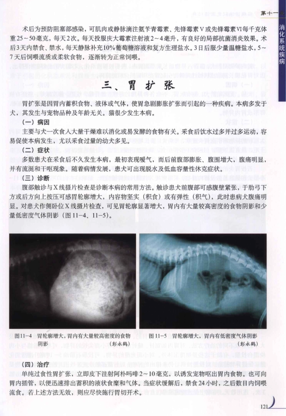 2025年医学资料：第11章消化系统疾病.PDF_第3页