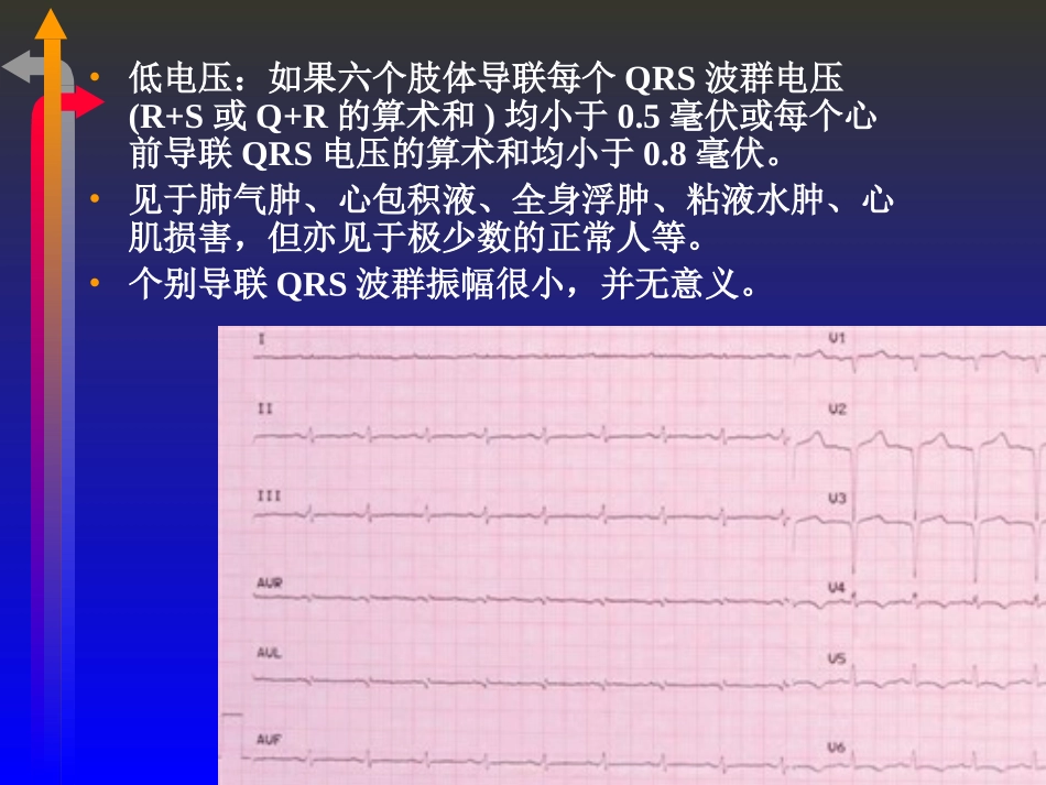 2025年医学资料：心电图－第二次课（3节）.ppt_第3页