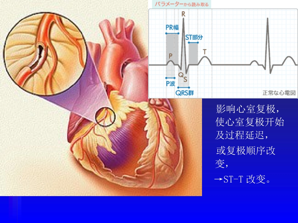 2025年医学资料：心电图－第三次课（4、5节）.ppt_第2页