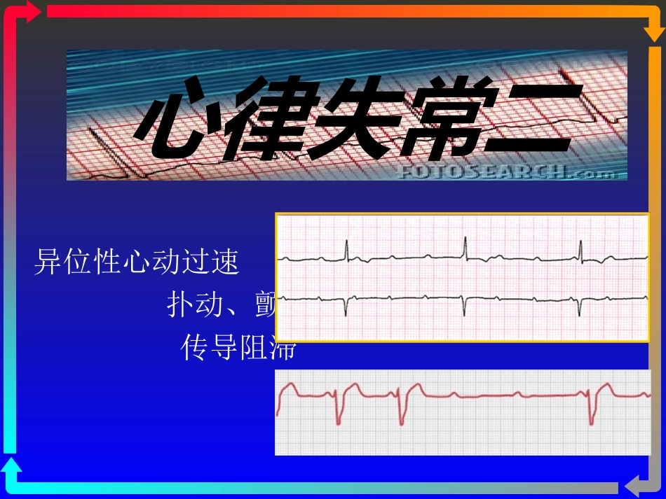 2025年医学资料：心电图－第五次课（心律失常二）.ppt_第1页