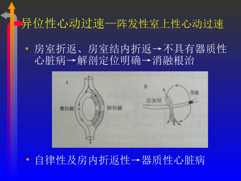 2025年医学资料：心电图－第五次课（心律失常二）.ppt_第2页