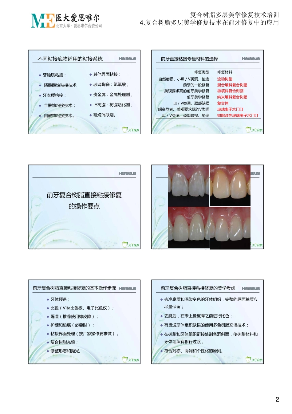 2025年医学资料：4.复合树脂多层美学修复技术在前牙修复中的应用.PDF_第2页