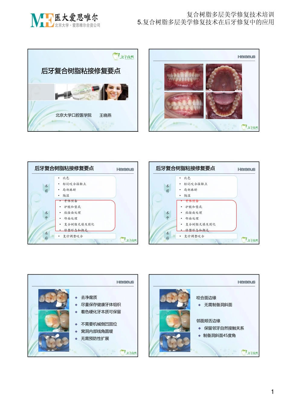 2025年医学资料：5.复合树脂多层美学修复技术在后牙修复中的应用.PDF_第1页