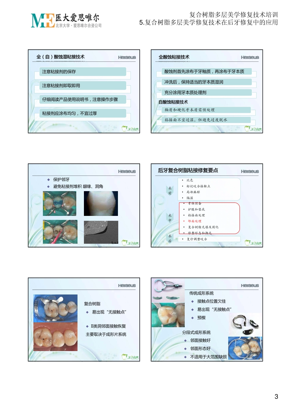 2025年医学资料：5.复合树脂多层美学修复技术在后牙修复中的应用.PDF_第3页