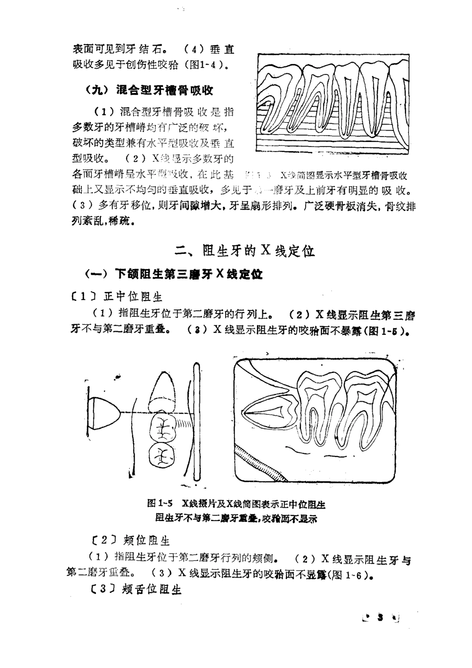 2025年医学资料：大川分享_口腔小手术指导 无封面.pdf_第3页