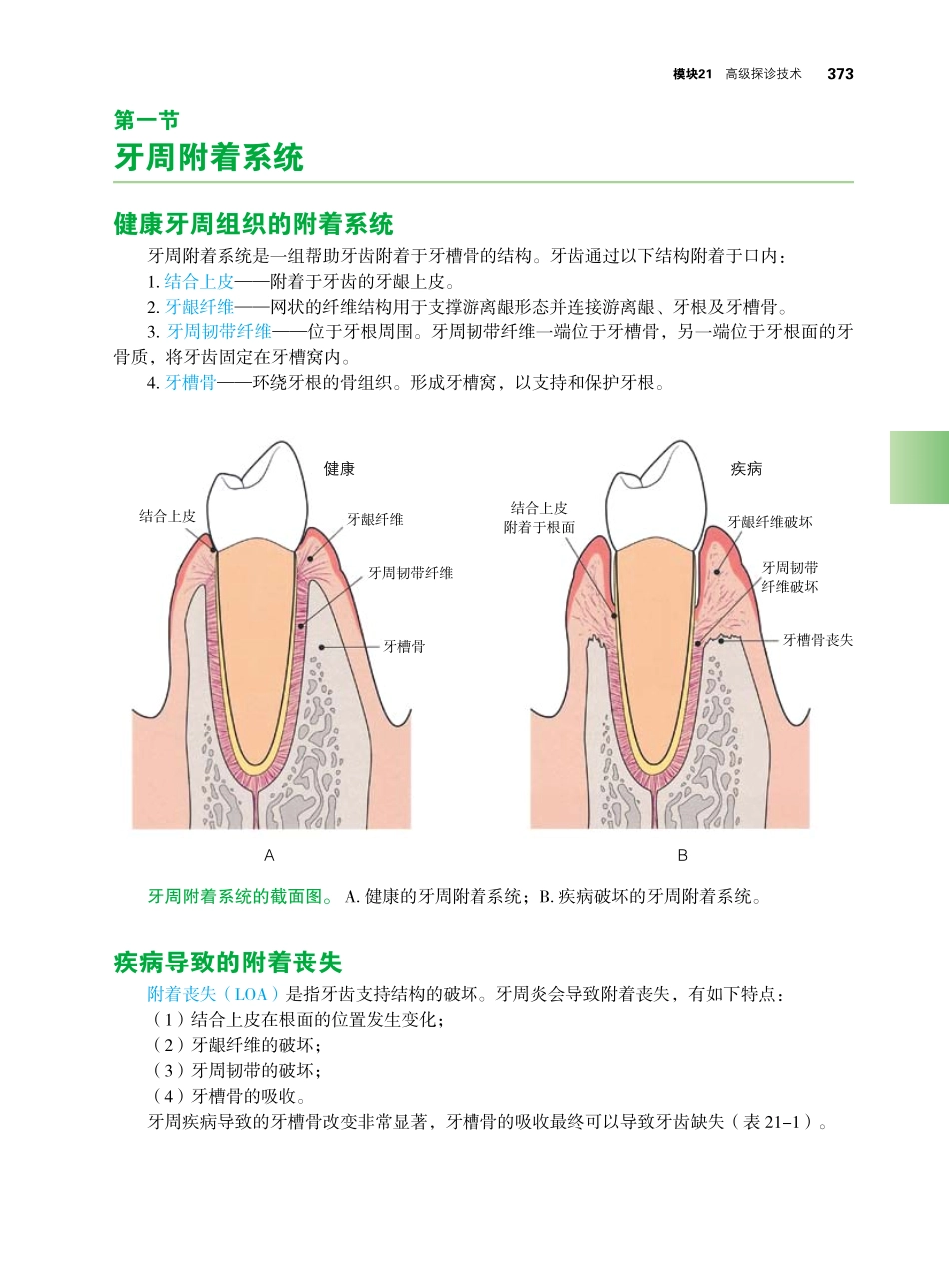 2025年医学资料：第五部分 高级刮治技巧.pdf_第3页