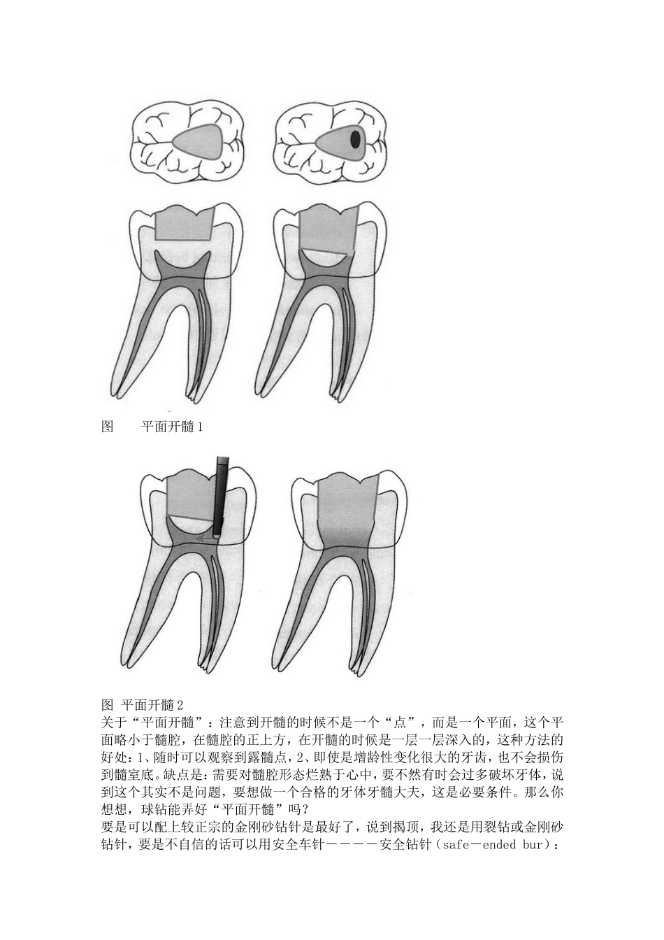 2025年医学资料：根管治疗器械的选择.doc_第2页