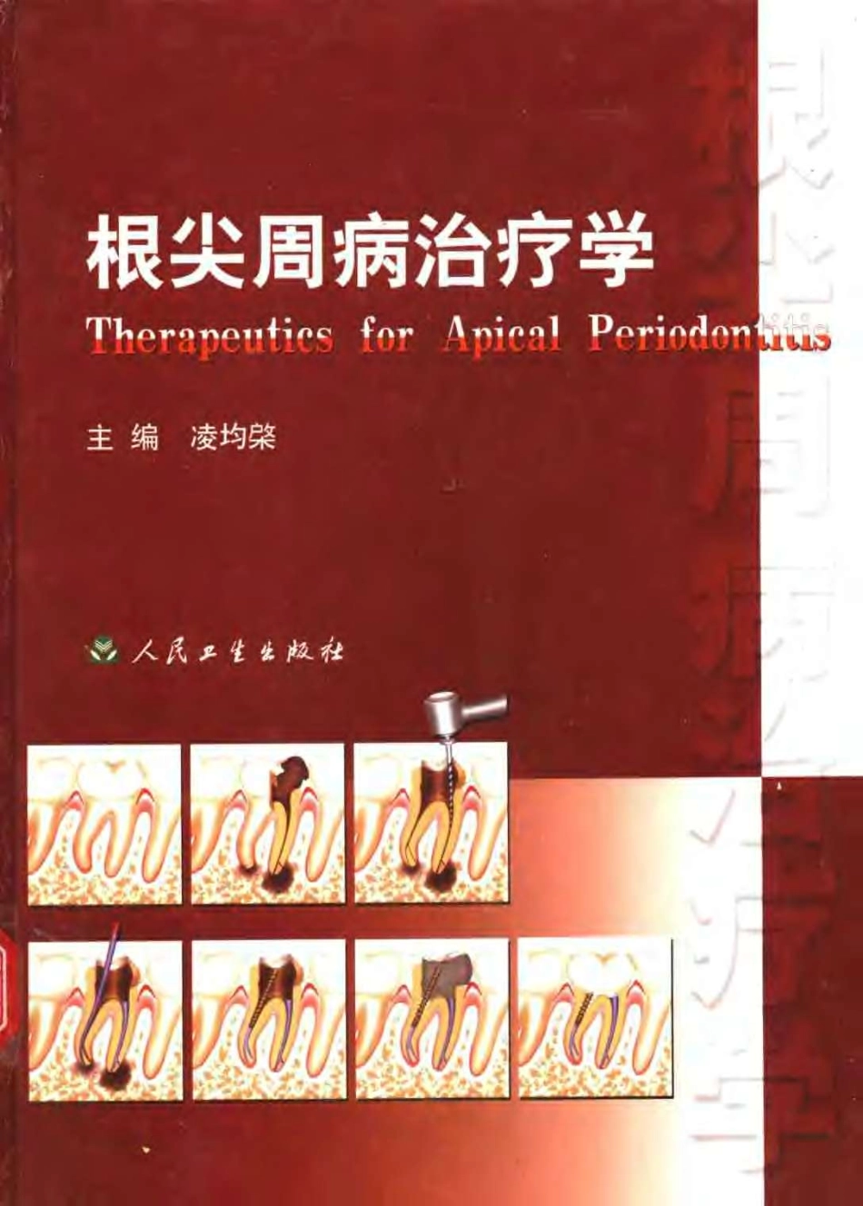 2025年医学资料：根尖周病治疗学.pdf_第1页