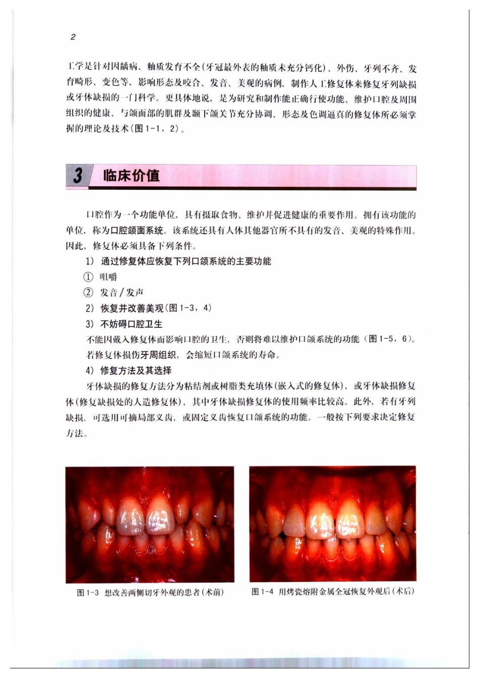 2025年医学资料：固定修复技工学.pdf_第2页