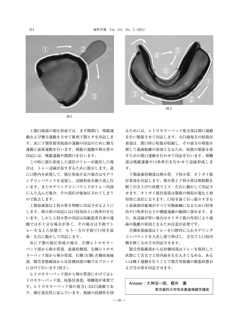 2025年医学资料：关于无牙颌印模的肌功能修整.pdf_第3页