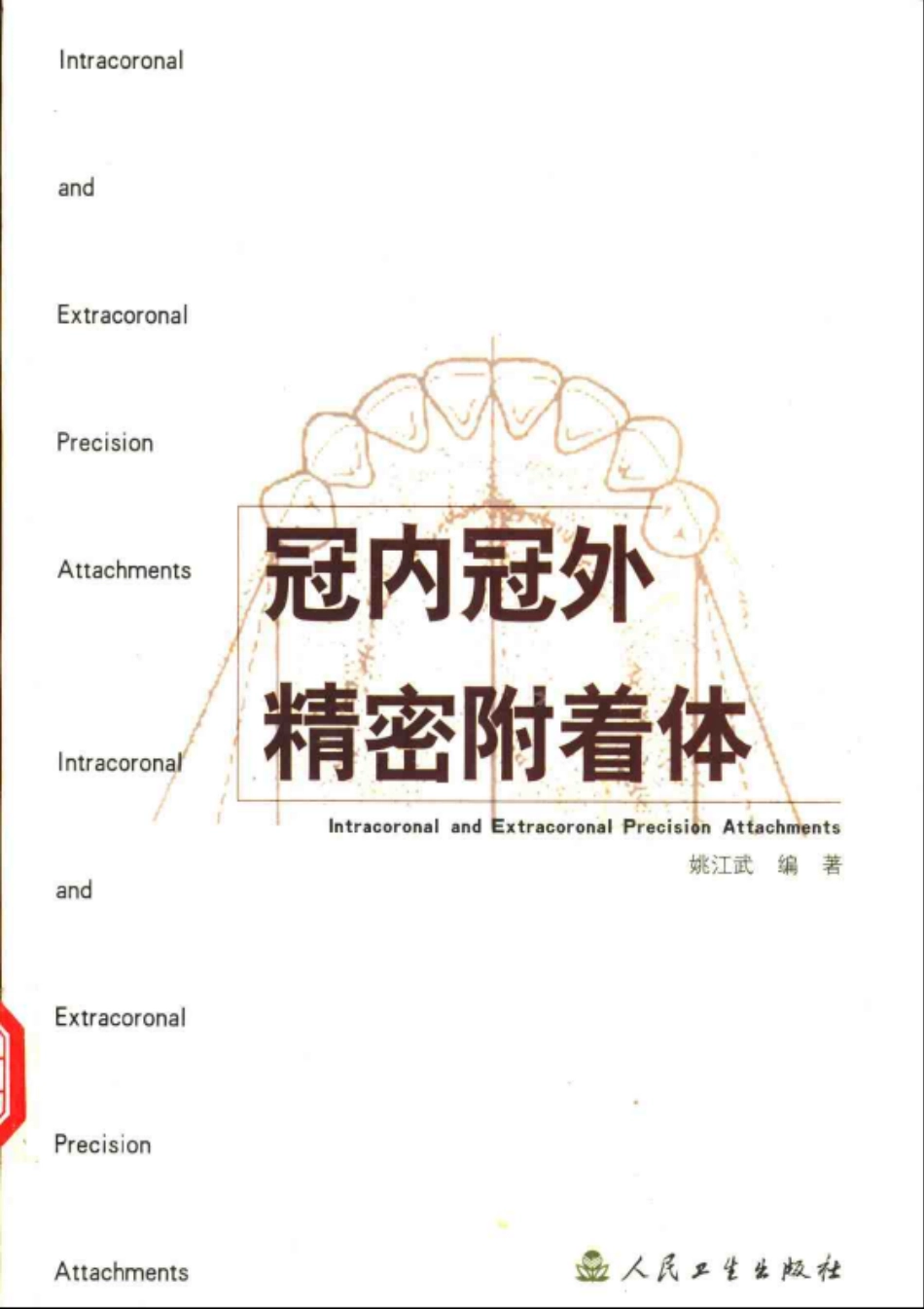 2025年医学资料：冠内冠外精密附着体+姚江武.pdf_第1页