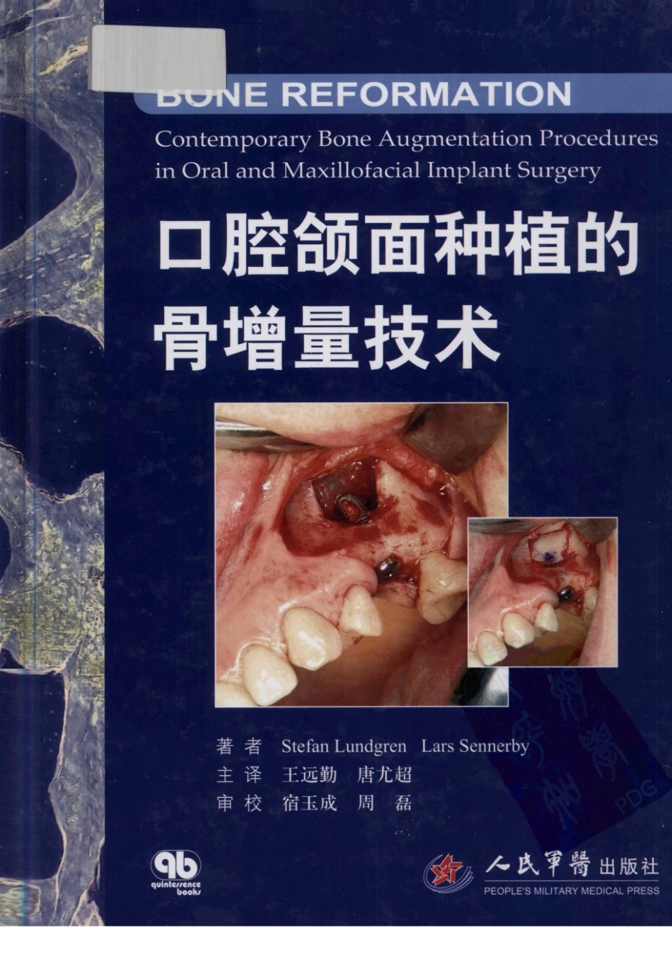 2025年医学资料：口腔颌面种植的骨增量技术.pdf_第1页