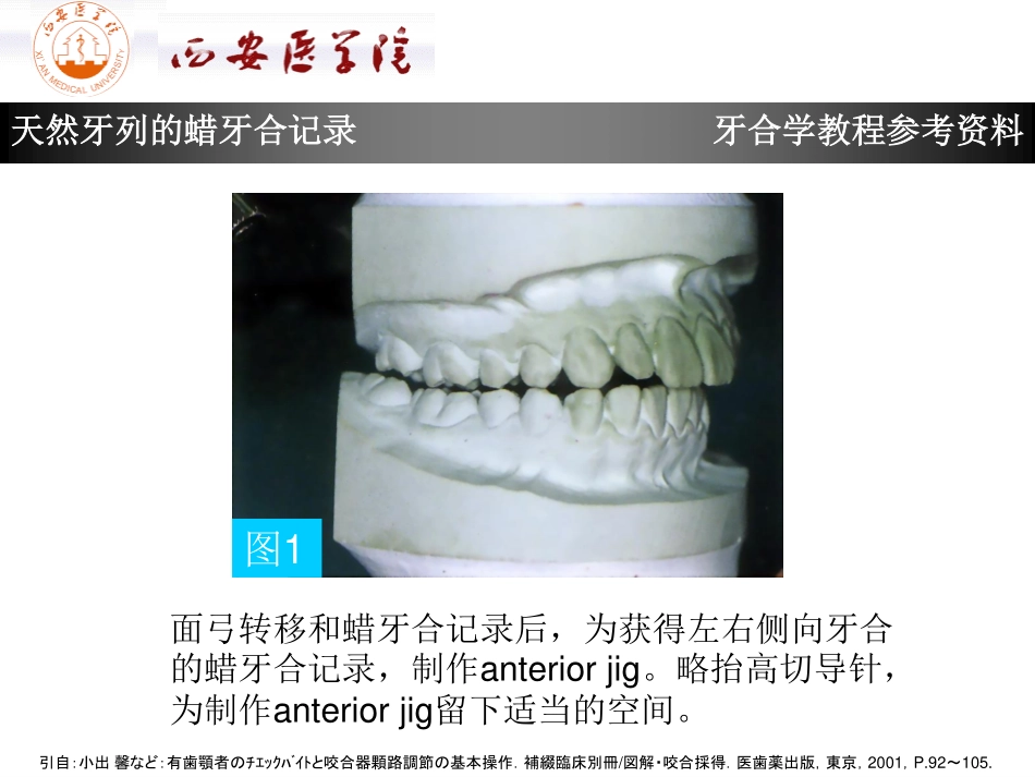 2025年医学资料：天然牙列的蜡牙合记录.pdf_第2页