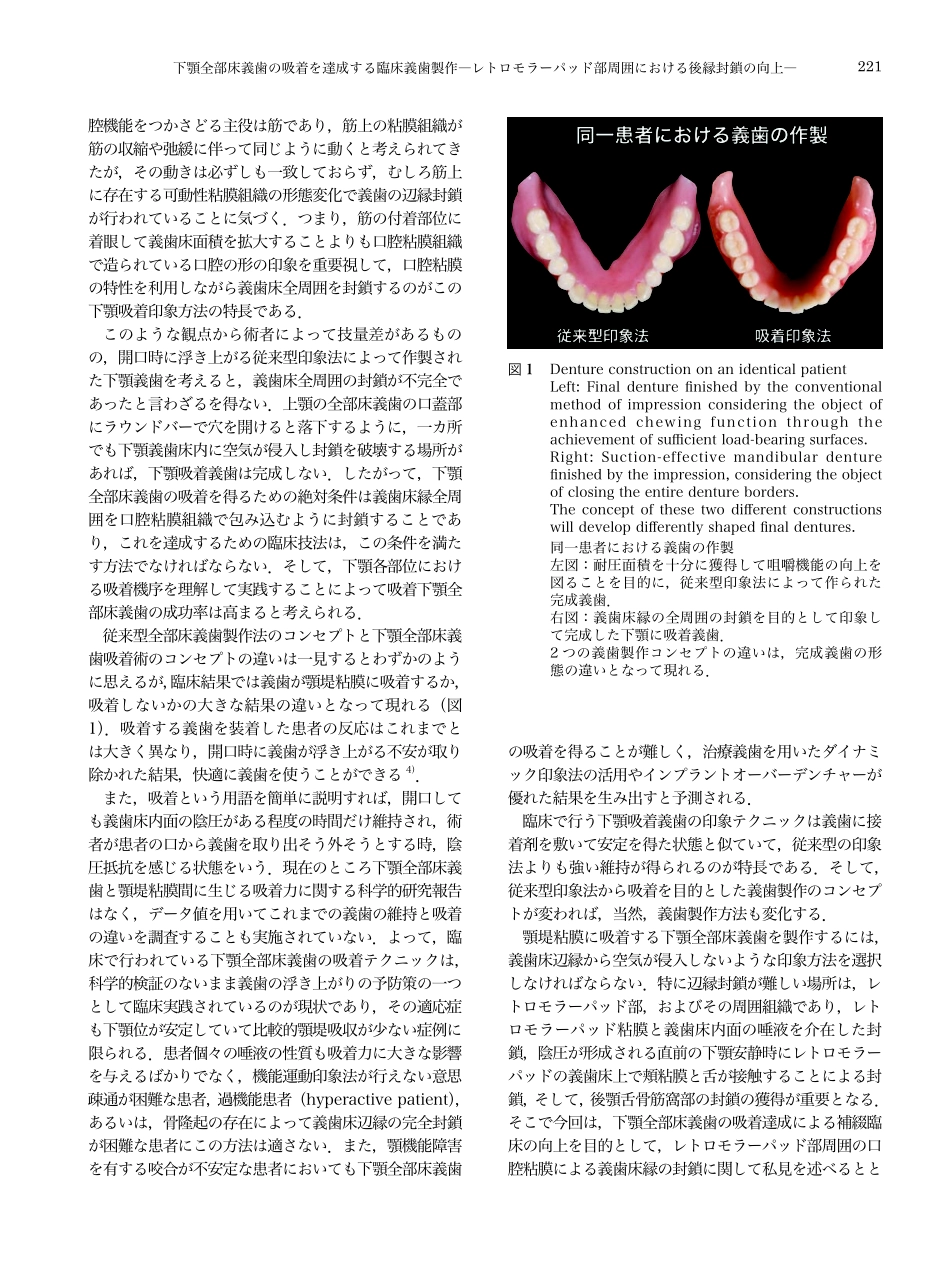 2025年医学资料：下颌吸着式义齿的制作.pdf_第2页