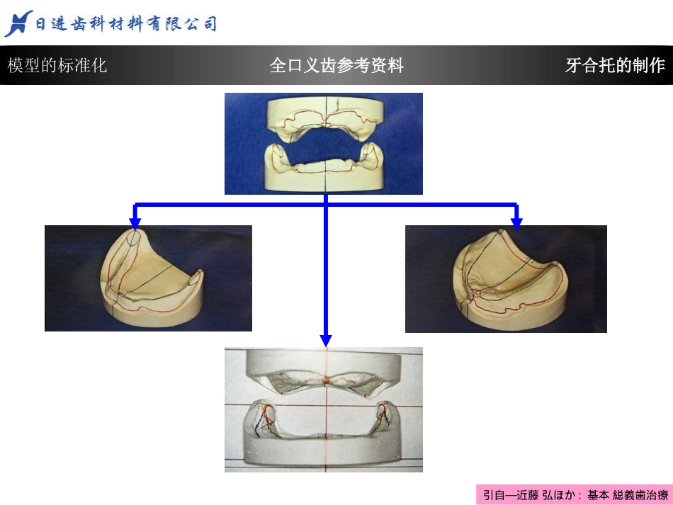 2025年医学资料：牙合托的制作1.ppt_第3页