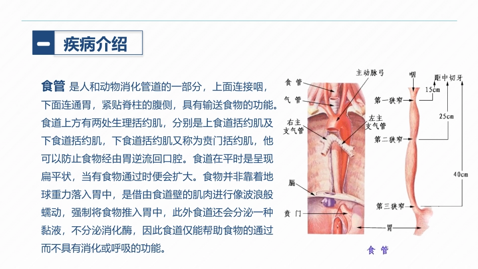 2025年医院护理课件：食管癌的护理.pptx_第3页