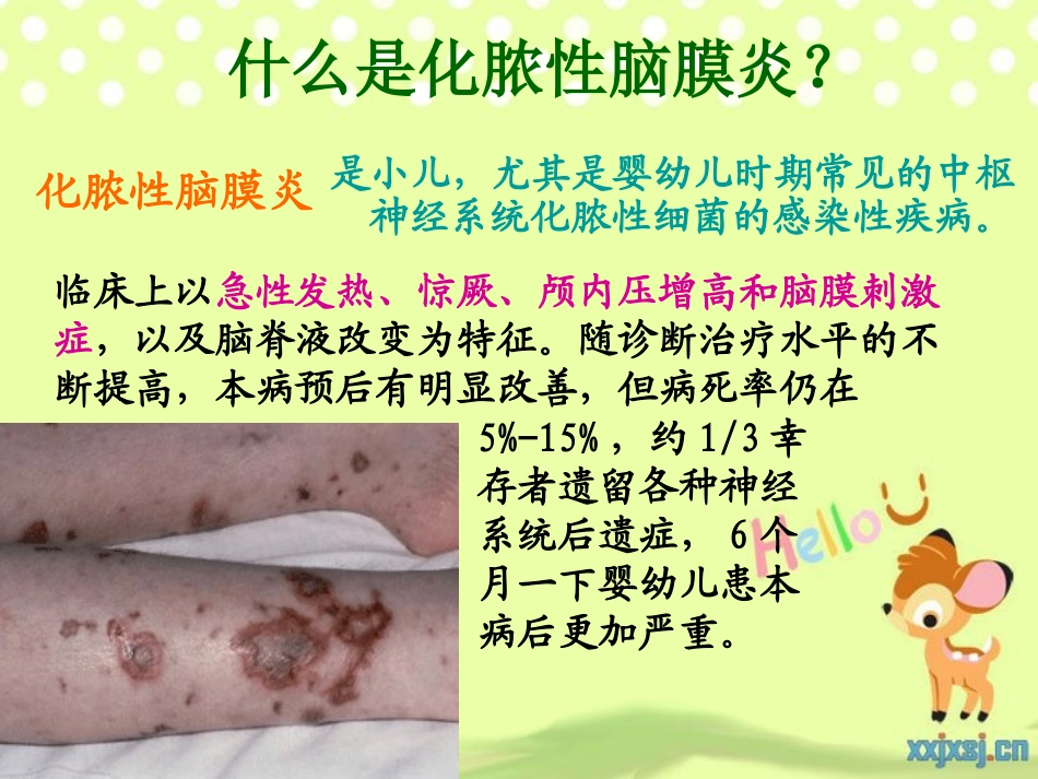 2025年慢性病知识讲座：化脓性脑膜炎PPT.ppt_第2页
