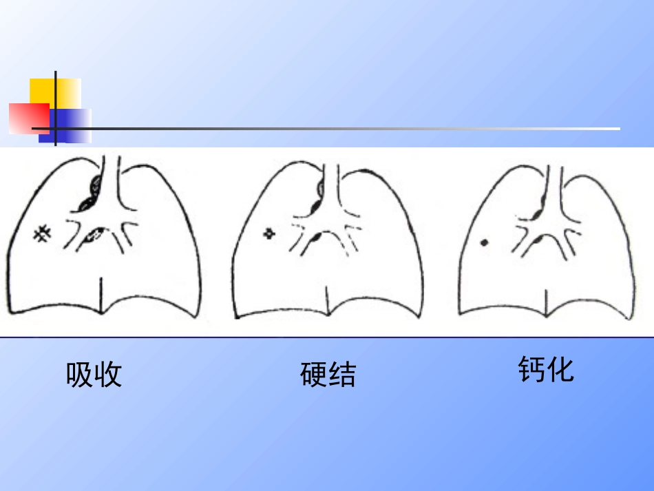 2025年慢性病知识讲座：抗结核治疗.ppt_第1页