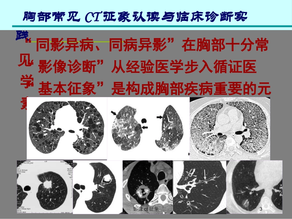 影像ct征象培训课件.pptx_第3页