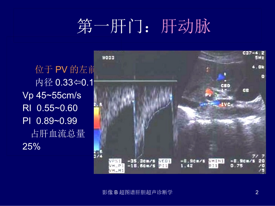 影像B超图谱肝胆超声诊断学培训课件.pptx_第2页