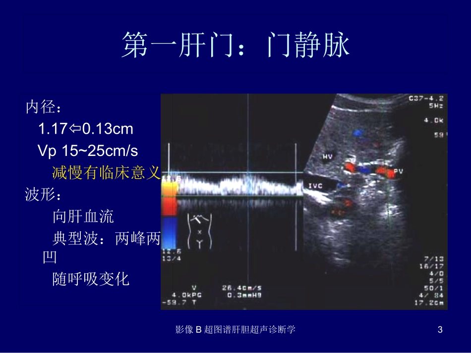 影像B超图谱肝胆超声诊断学培训课件.pptx_第3页