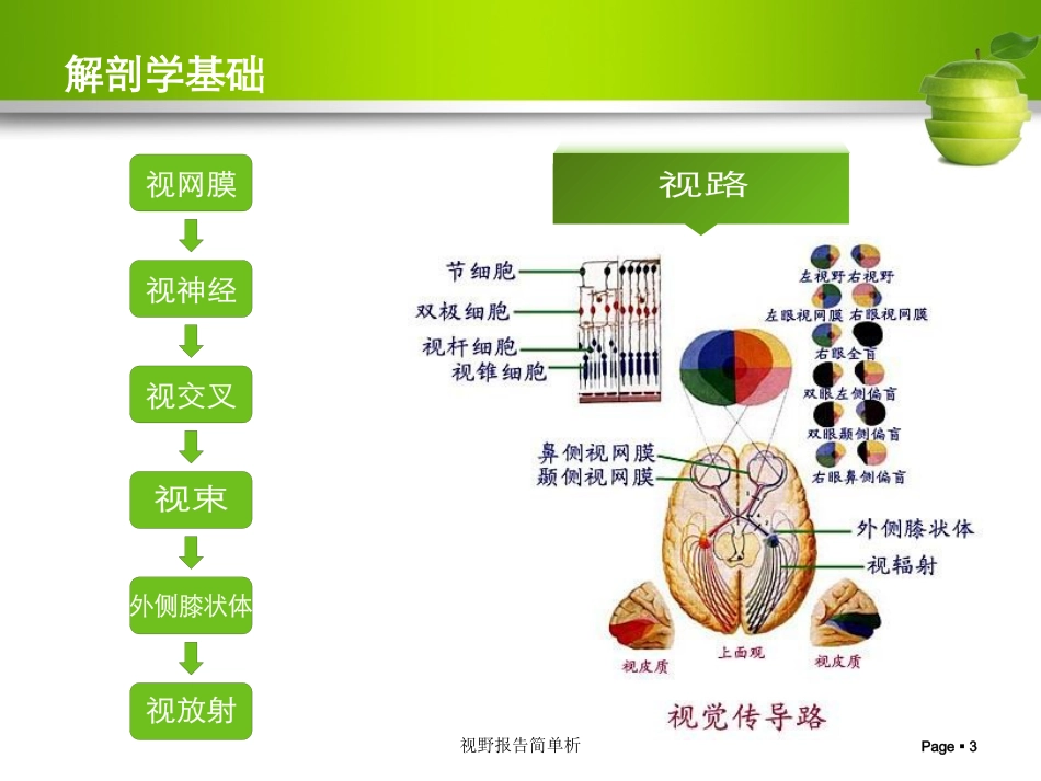 视野报告简单析培训课件.pptx_第3页