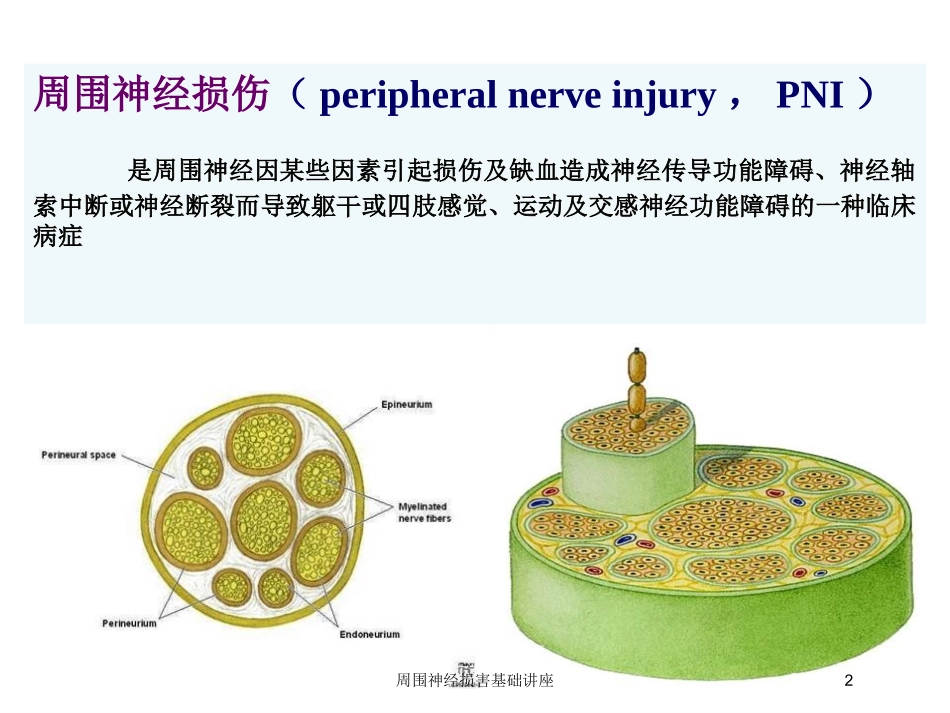 周围神经损害基础讲座培训课件.pptx_第2页