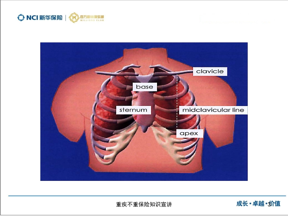 重疾不重保险知识宣讲培训课件.pptx_第3页