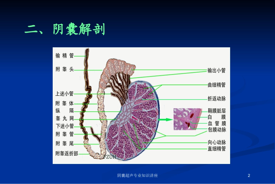 阴囊超声专业知识讲座培训课件.pptx_第2页