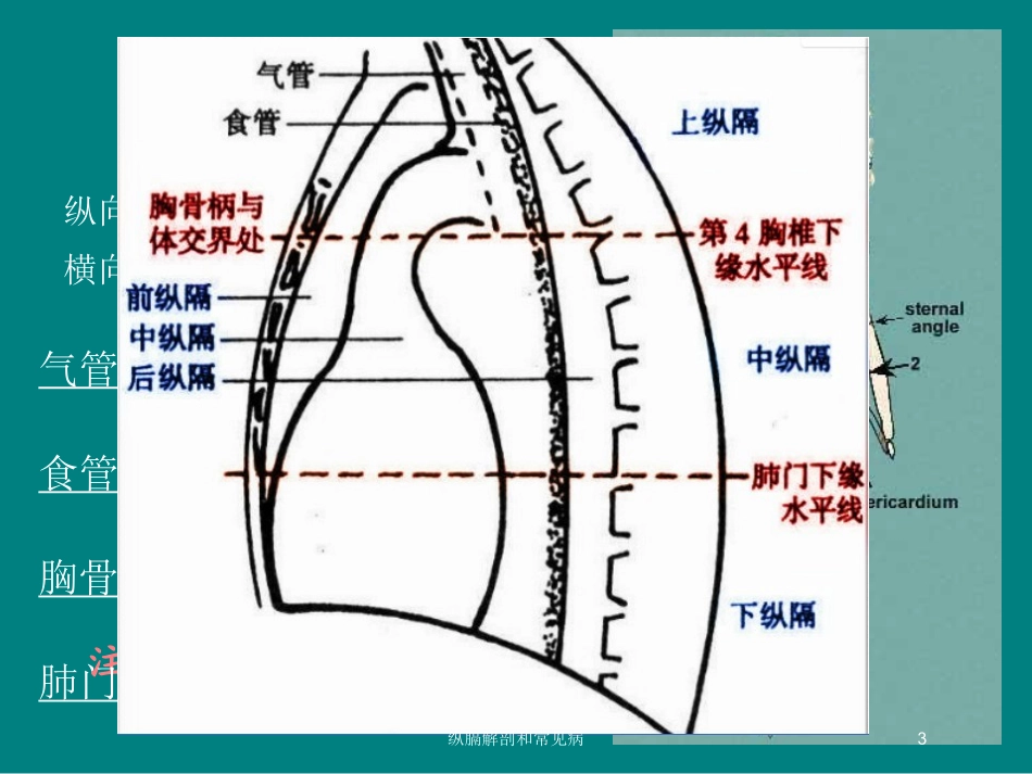 纵膈解剖和常见病培训课件.pptx_第3页