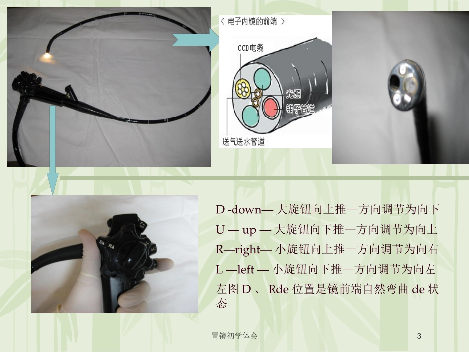 胃镜初学体会培训课件.pptx_第3页